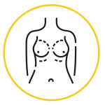 Brustvergrößerung (Mammaaugmentation)